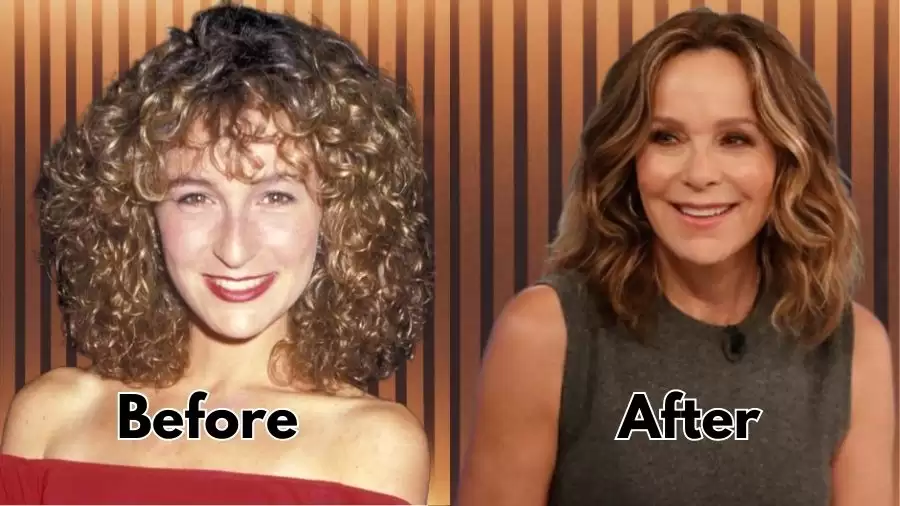 Jennifer Grey Before and After Plastic Surgery, Nose Job and More