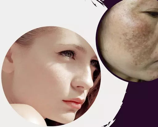 bột sắn dây và mật ong để đắp mặt nạ