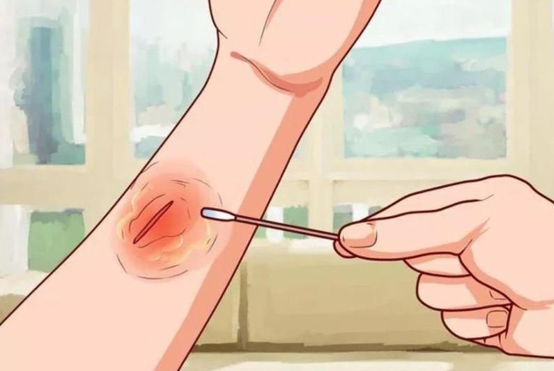 chua-lanh-vet-thuong